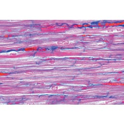 Image for Johannes Lieder Muscle Types Slides, Set of 3 from School Specialty