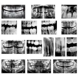 Image for Roylco Dental X-Rays and Charts, 17 Pieces from School Specialty